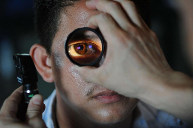 Czym charakteryzuje się choroba wzroku AMD?
