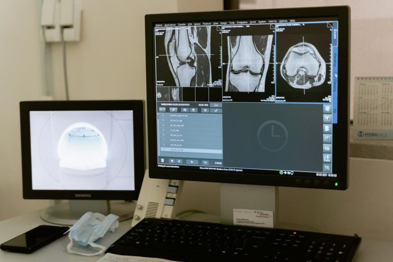 Skleroterapia w częstochowie – bezpieczna metoda walki z żylakami